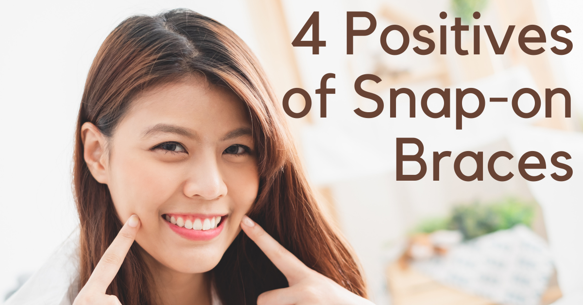 4 Positives of Snap-on Braces