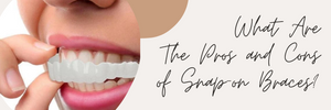What Are The Pros and Cons of Snap-on Braces?