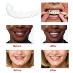 Load image into Gallery viewer, Perfect Smile Snap-On Braces
