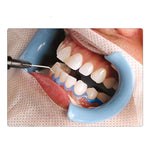 Load image into Gallery viewer, The Tooth Whitening And Gum Protection Tool
