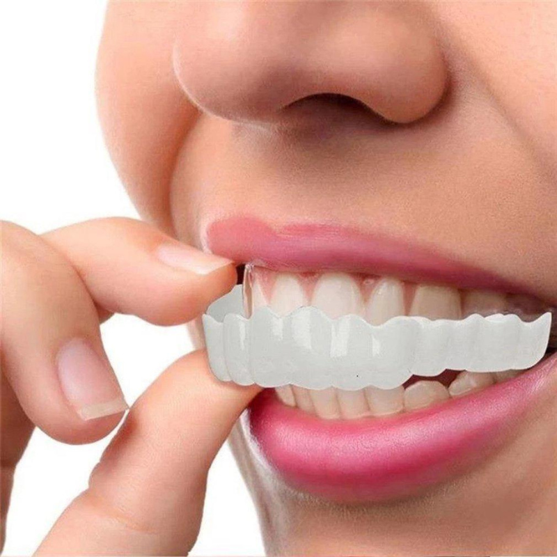 Magic Teeth Brace Veneers