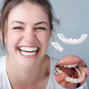 Perfect Smile Snap-On Braces