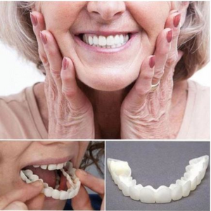 Perfect Snap-On Smile Braces